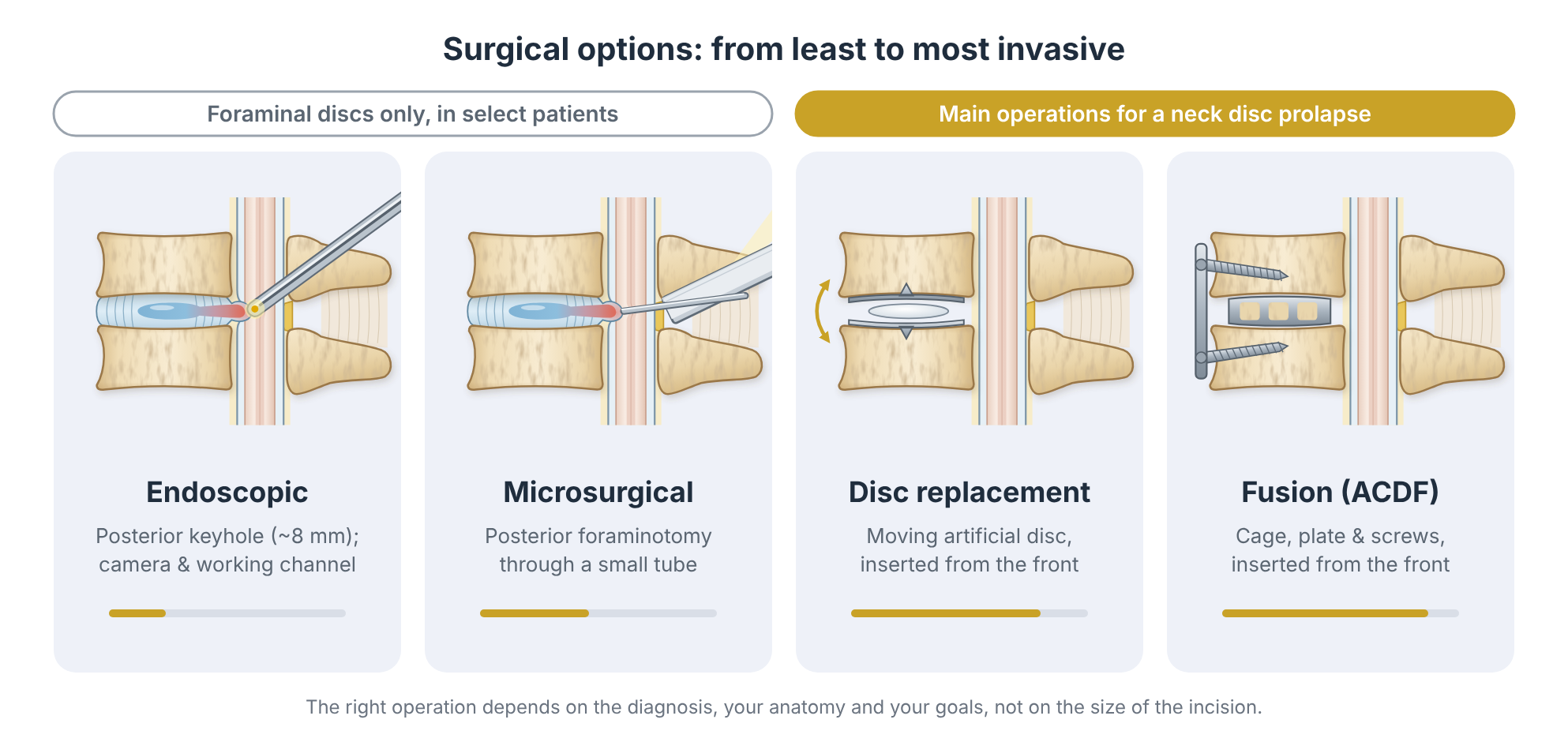 Comparison of endoscopic surgery, microsurgical decompression, disc replacement and spinal fusion