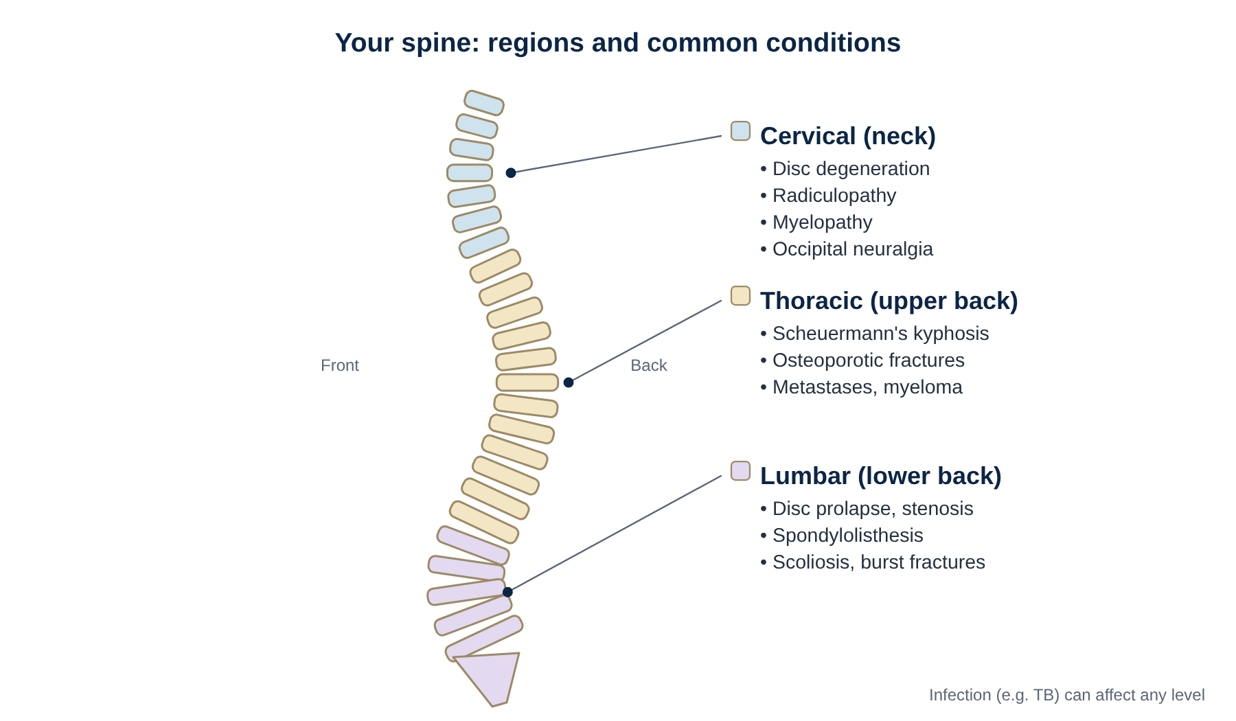 Side view of the spine showing cervical, thoracic and lumbar regions and their common conditions