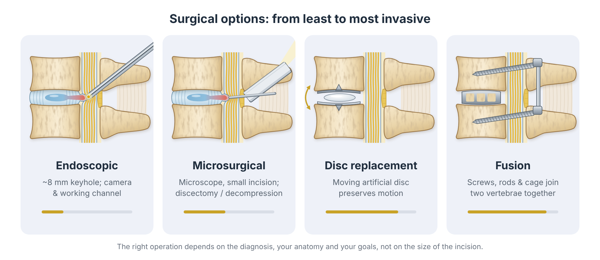 Comparison of endoscopic surgery, microsurgical decompression, disc replacement and spinal fusion